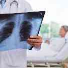 Arzt schaut sich die Röntgenaufnahme von einer Frau im Krankenhaus an.